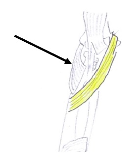 Pronator Teres