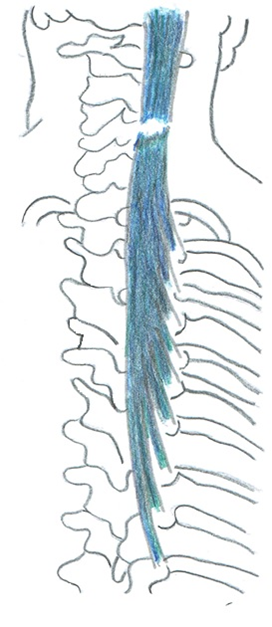 Semispinalis Capitis