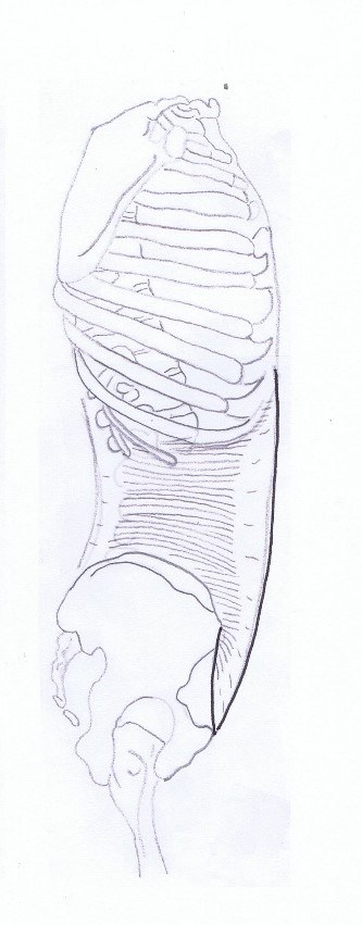 Transversus abdominis